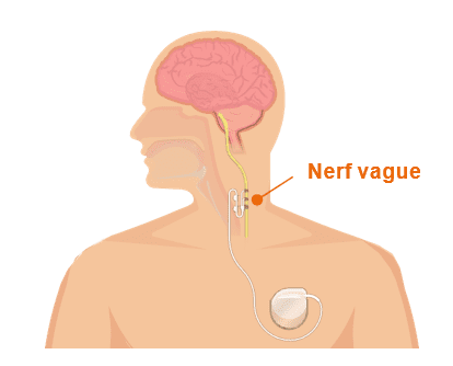 Nerf vague : définition, schéma du nerf pneumogastrique